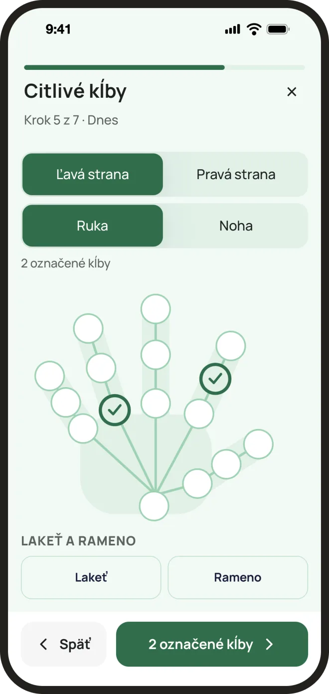 Mapa tela v aplikácii FlareEase: obrys ruky s kĺbmi, dva sú označené ako citlivé